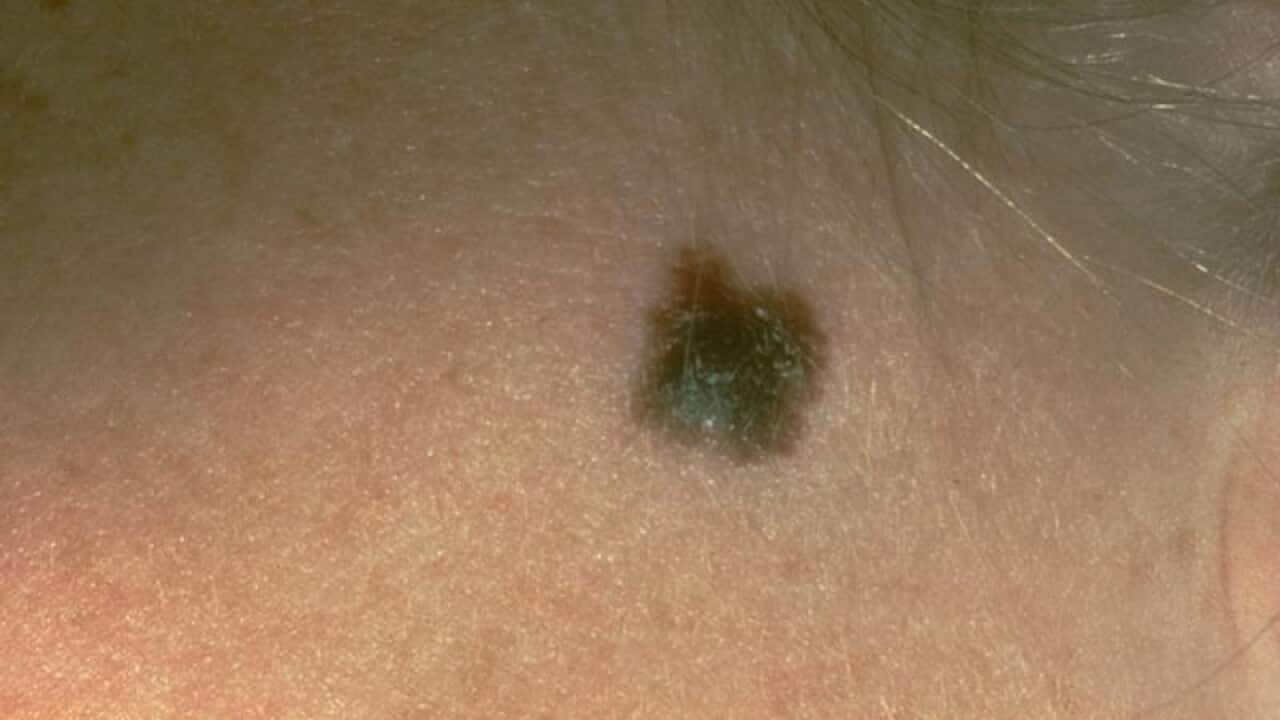 (American Academy of Dermatology via AP)