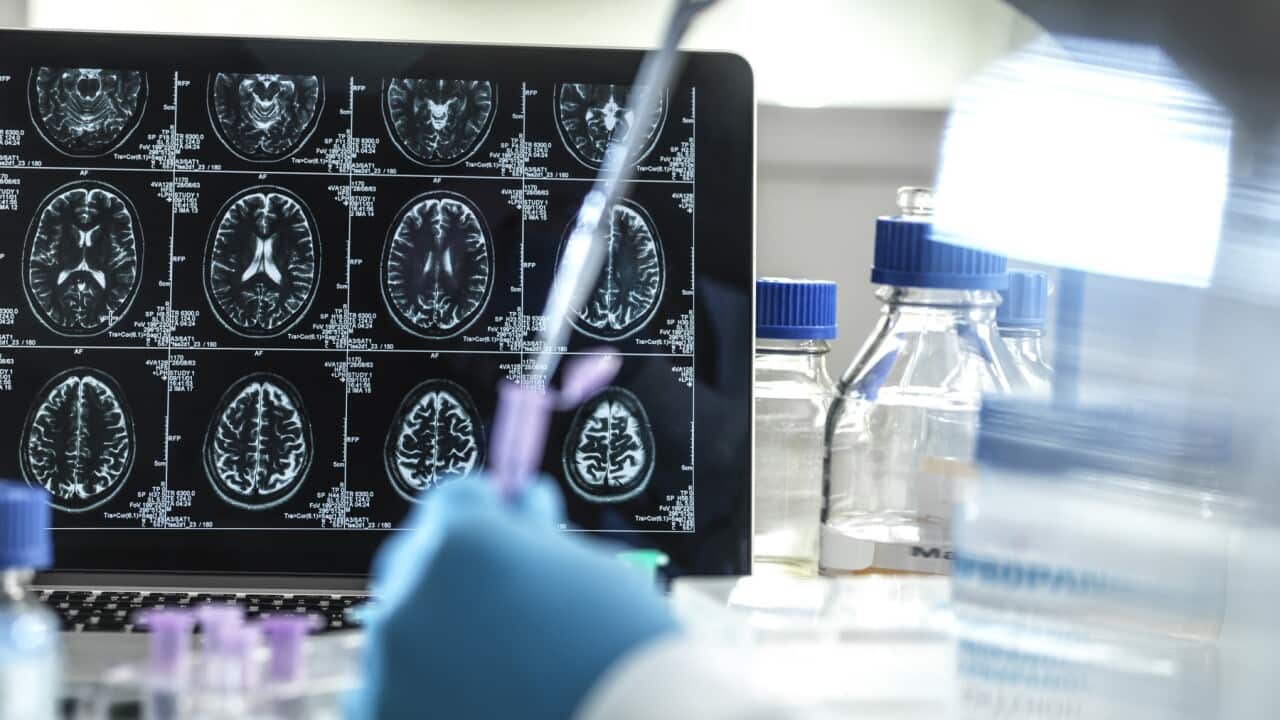 Alzheimers and dementia research