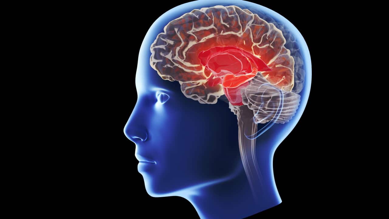 Alzheimer's disease affecting the hippocampus, illustration