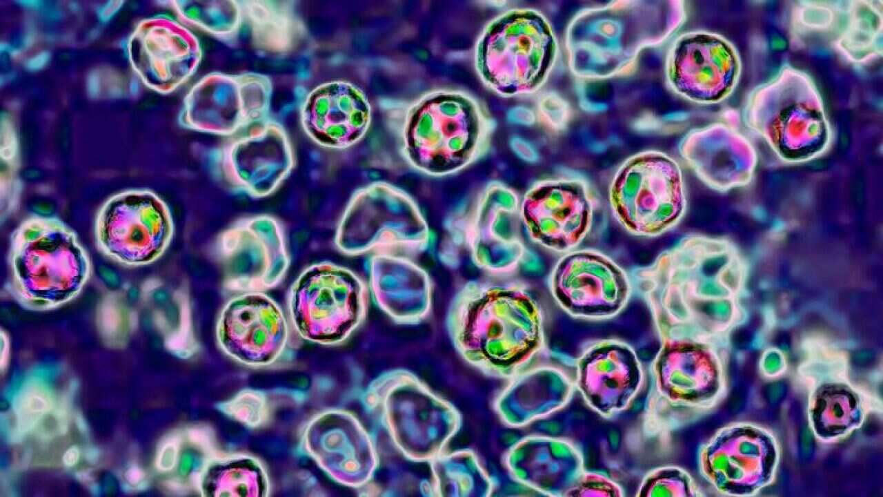 The measles virus, paramyxoviridae, from the Morbillivirus family