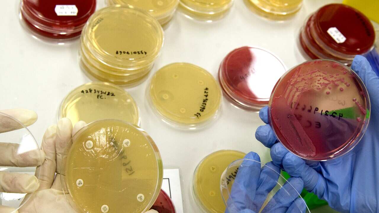 NEW SUPERBUG BRISBANE