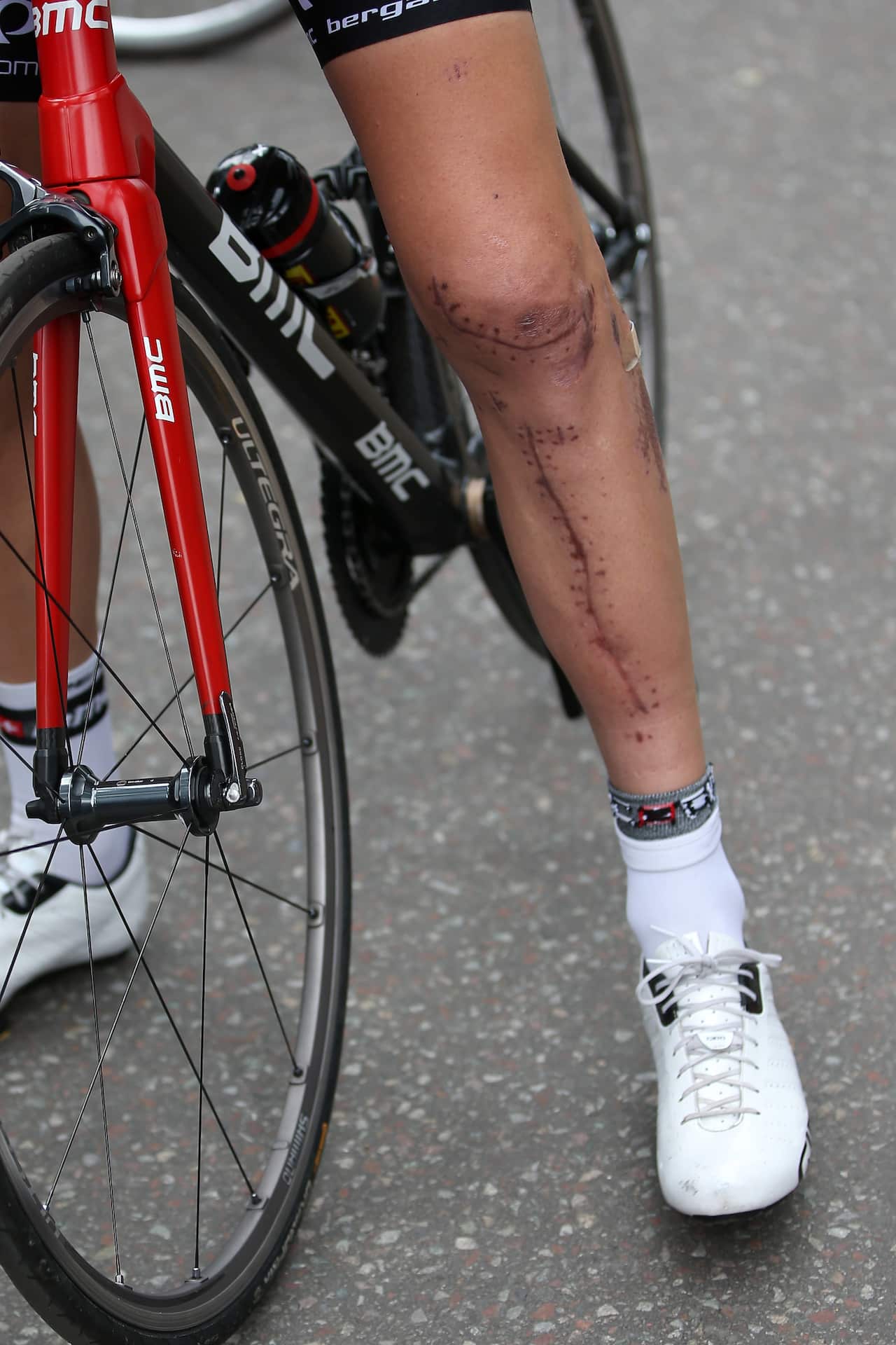 War wounds... Taylor Phinney's left leg, one month after his horrific crash at the 2014 national road championships in Chattanooga, Tennessee.