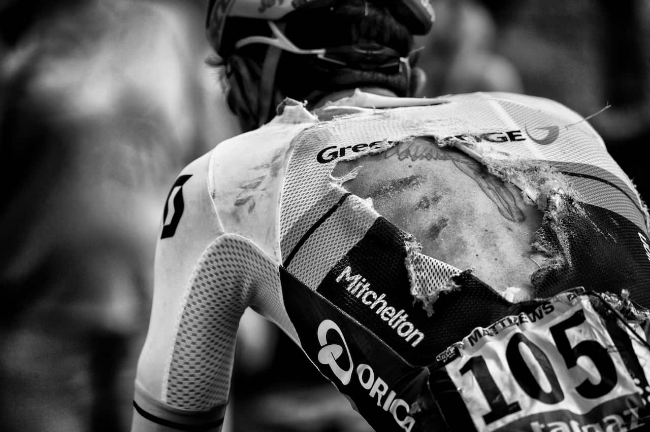 One ugly day... Matthews was badly hurt after a mass pile-up on Stage 3 of this year's Tour de France.