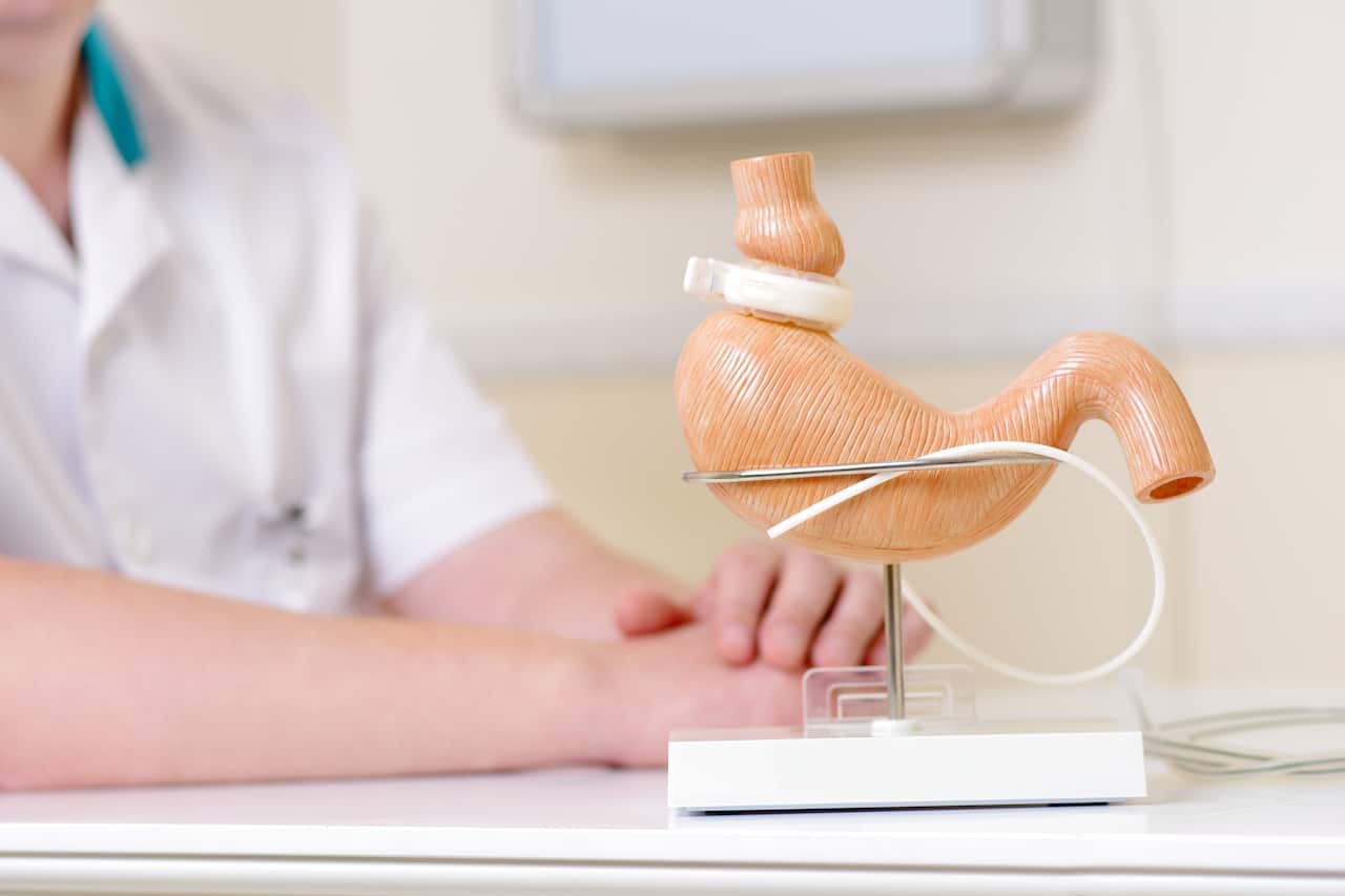 A lap-band is placed on a replica stomach. This medical procedure is used to help those with obesity.