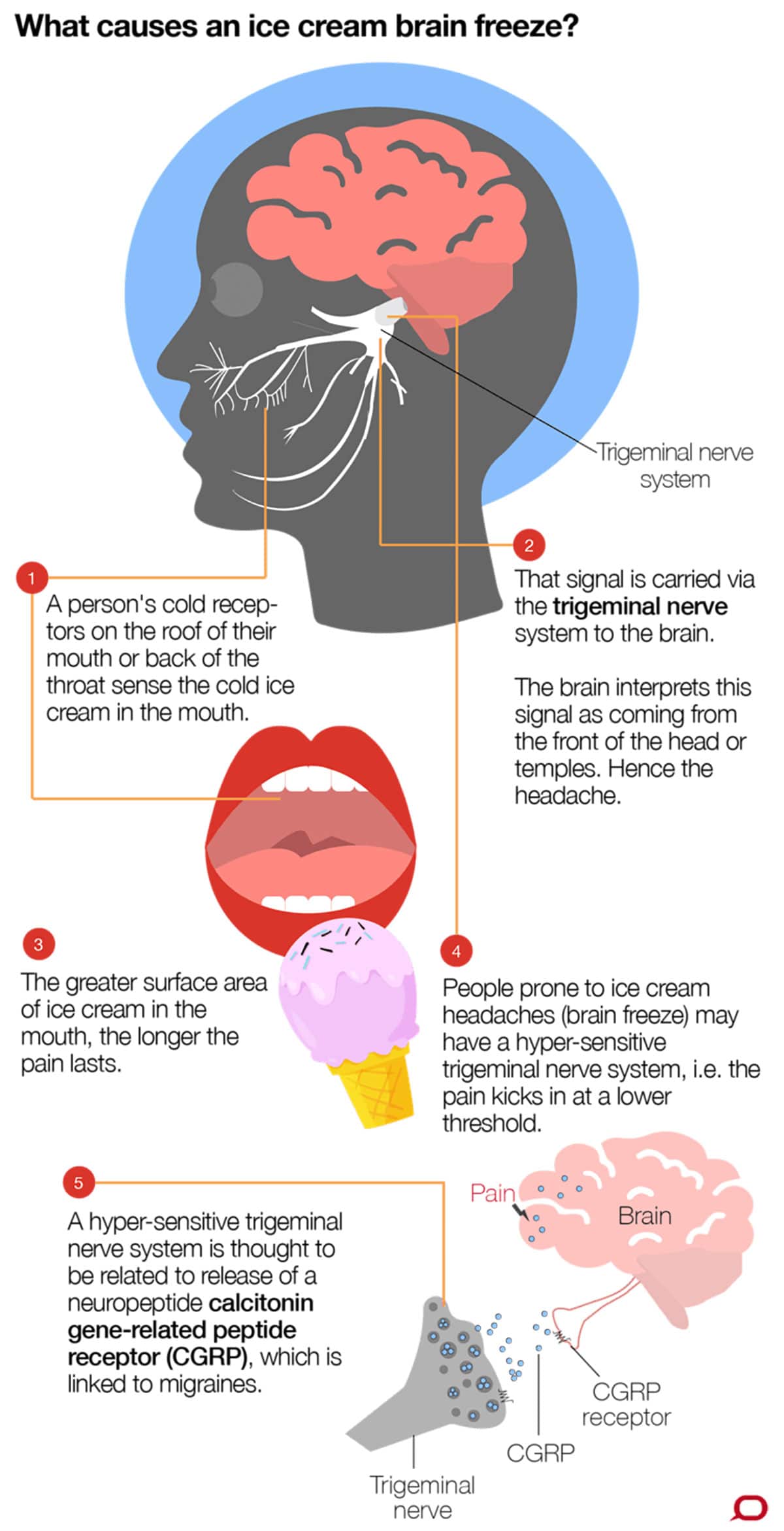 Brain freeze diagram 