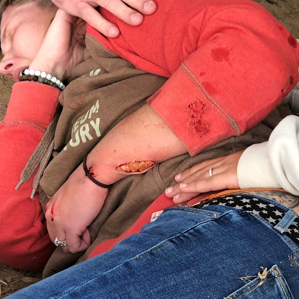 The jaguar left lacerations in the woman’s arm, but her injuries were non-life-threatening.