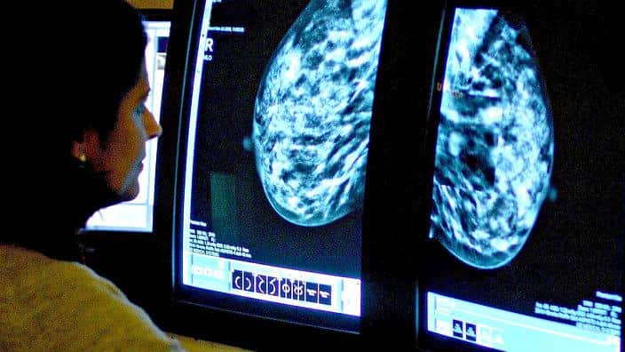Breast cancer imaging