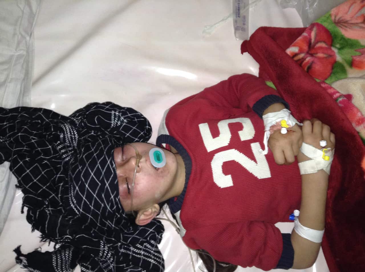 A girl who was wounded after a stampede broke out at an Afghan school killing 12 school girls.
