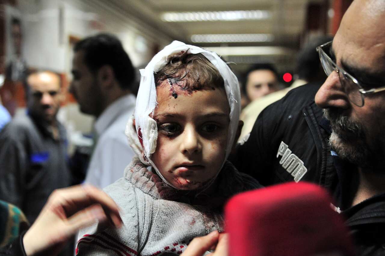 A handout picture made available by the Syrian Arab News Agency (SANA) shows a wounded Syrian child at a hospital in Damascus, Syria, 21 February 2016. 