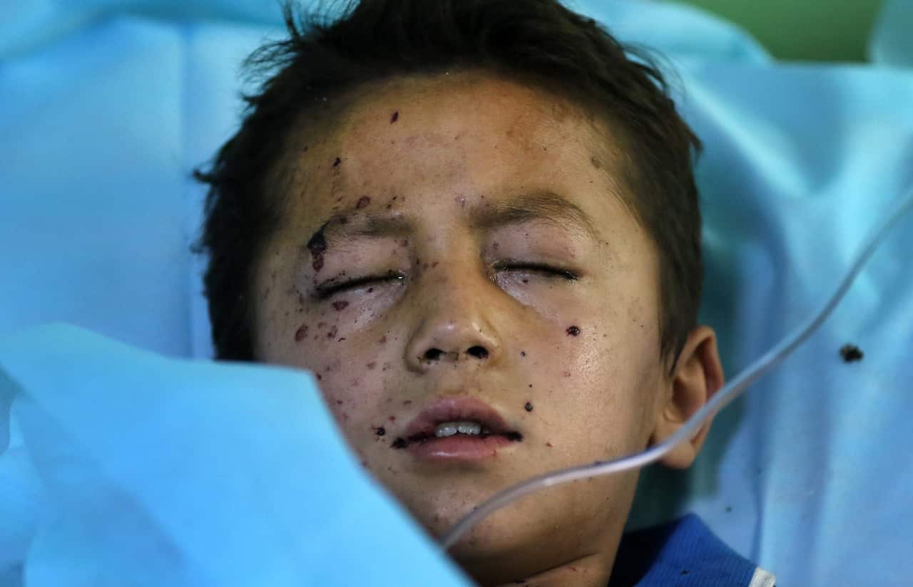 An Afghan boy who was wounded in a suicide bomb attack that targeted a Shiite Muslims religious school, receives medical treatment at a hospital, in Kabul