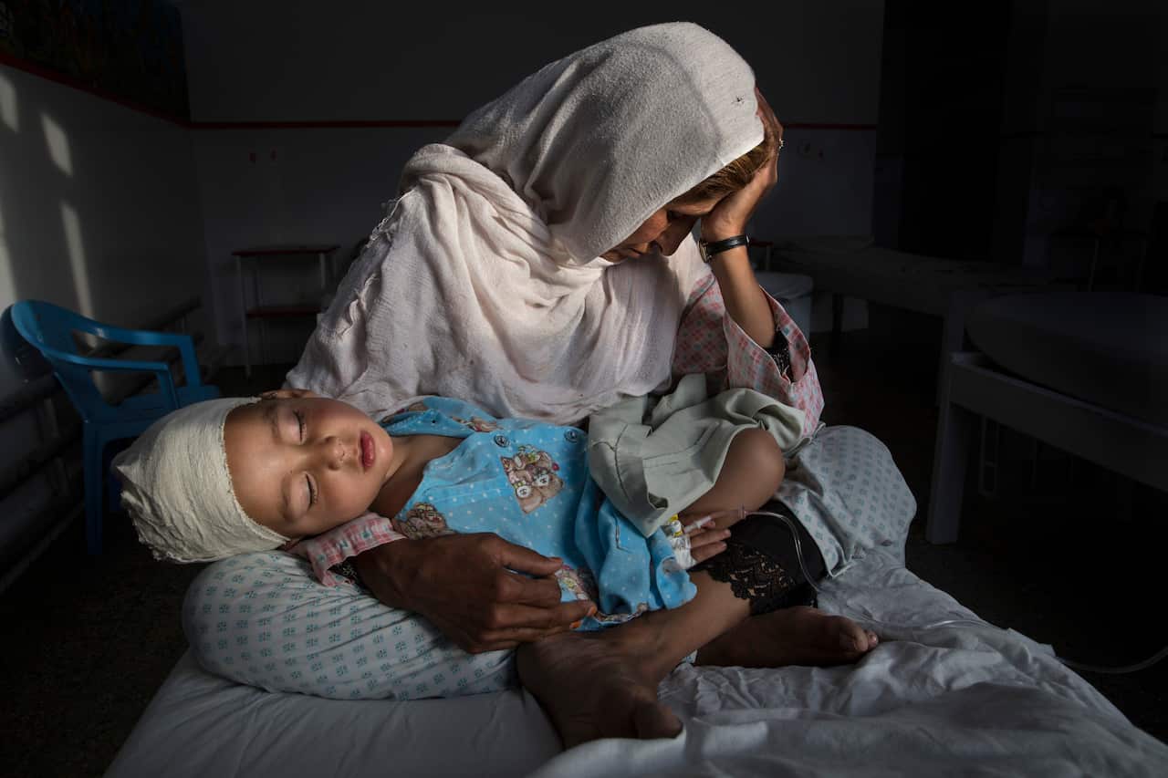 An Afghan woman holds her two-year-old nephew injured from a bomb blast in Kabul on 29 March 2016.