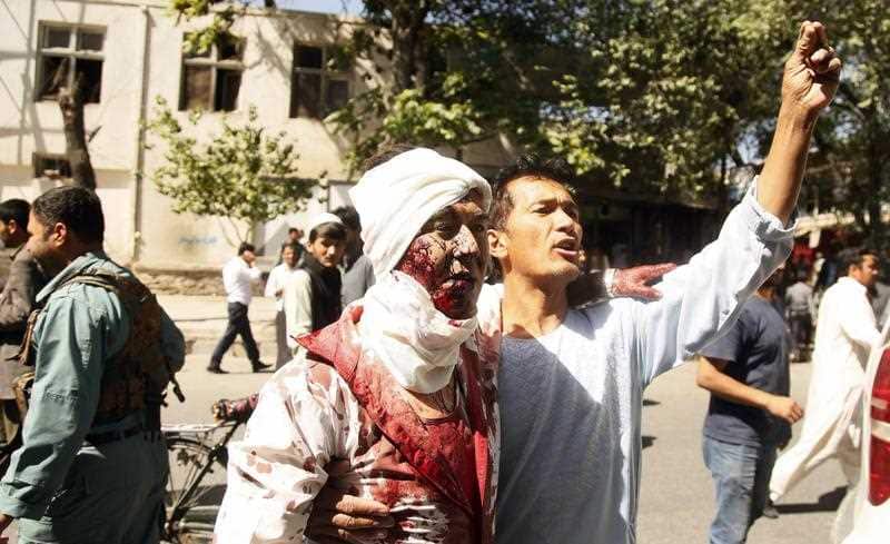 A man who was injured in a suicide bomb attack, reacts at the scene, in Kabul, Afghanistan, 31 May 2017. 