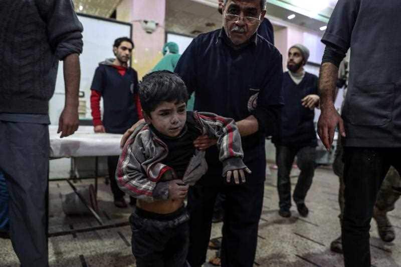An injured child receives treatment, after getting injured in an alleged bombing by forces loyal to the Syrian government, rebels-held Douma