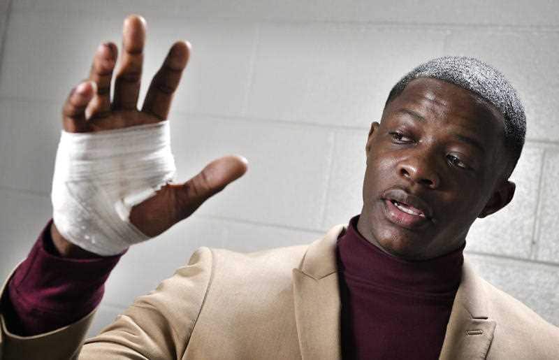 James Shaw Jr., shows his hand that was injured when he disarmed a shooter inside a Waffle House on Sunday, April 22, 2018, in Nashville, Tenn.