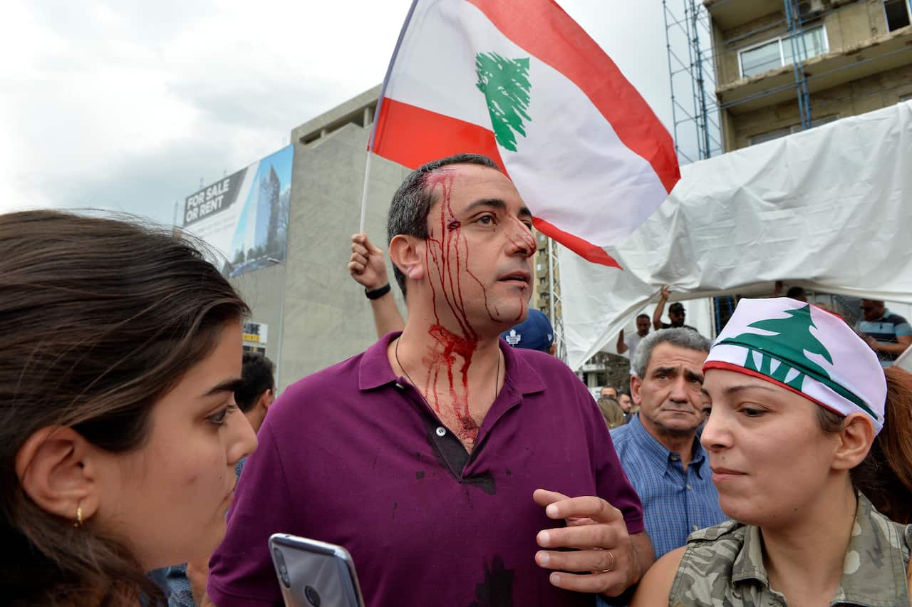 A bloodied protester during a clash with the Lebanese army soldiers as they try to open the highway during a protest in Jal El Dib area north of Beirut.