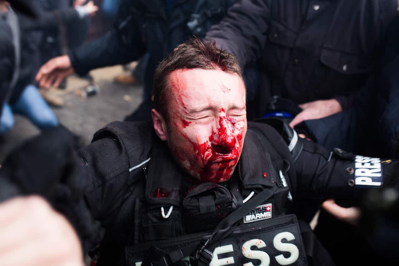 A journalist is injured and bleed during the Demonstration of the "yellow jacket" (yellow vests) marking the first anniversary of the movement near the Place d'Italie, Paris, France, on 16 November 2019. Photo by Raphael Lafargue/ABACAPRESS.COM.