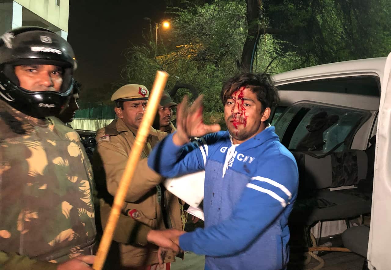 Policemen detain an injured student outside Jamia Millia Islamia university during a protest against the Citizenship Amendment Act in New Delhi, India.