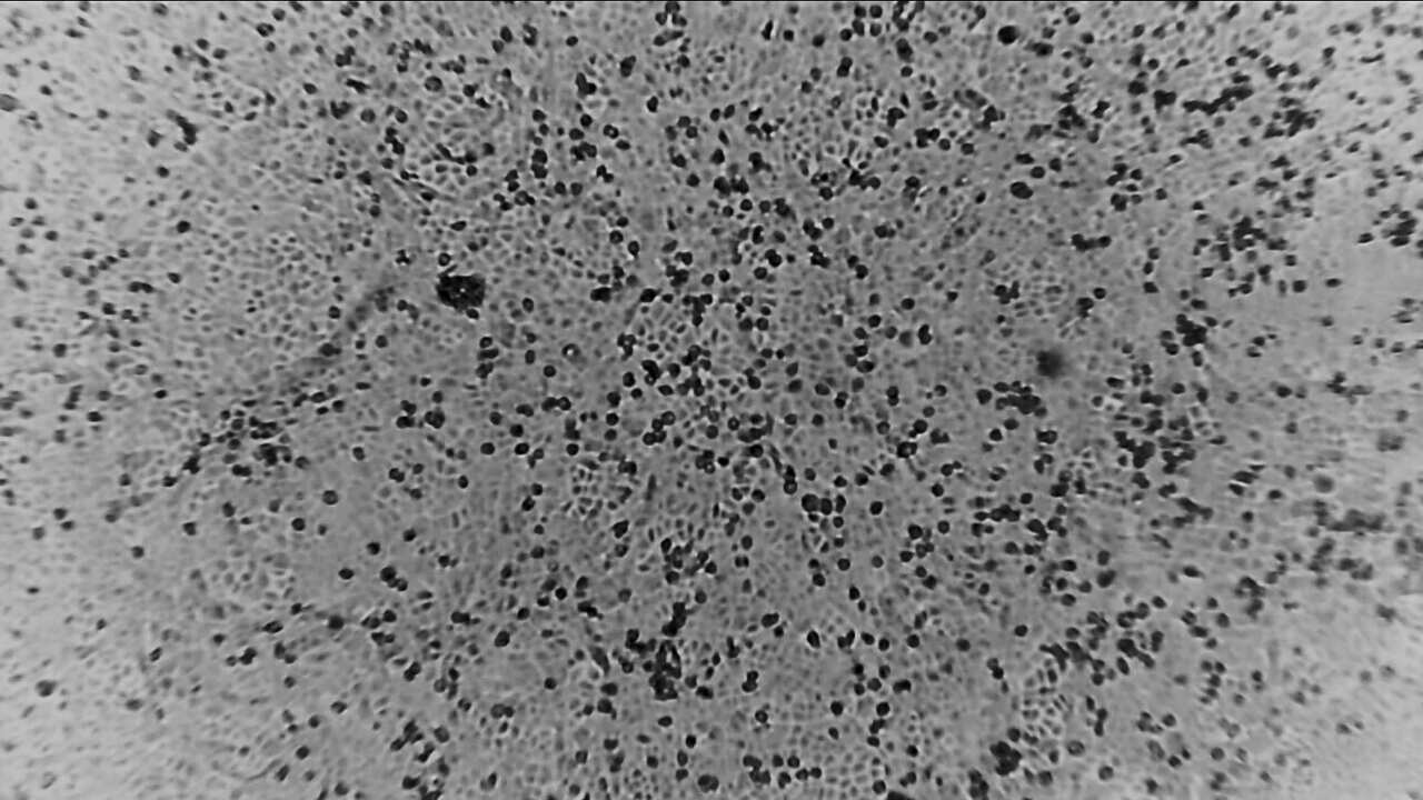 Scientists from The Peter Doherty Institute for Infection and Immunity were able to succesfully grow a version of the Coronavirus in January.