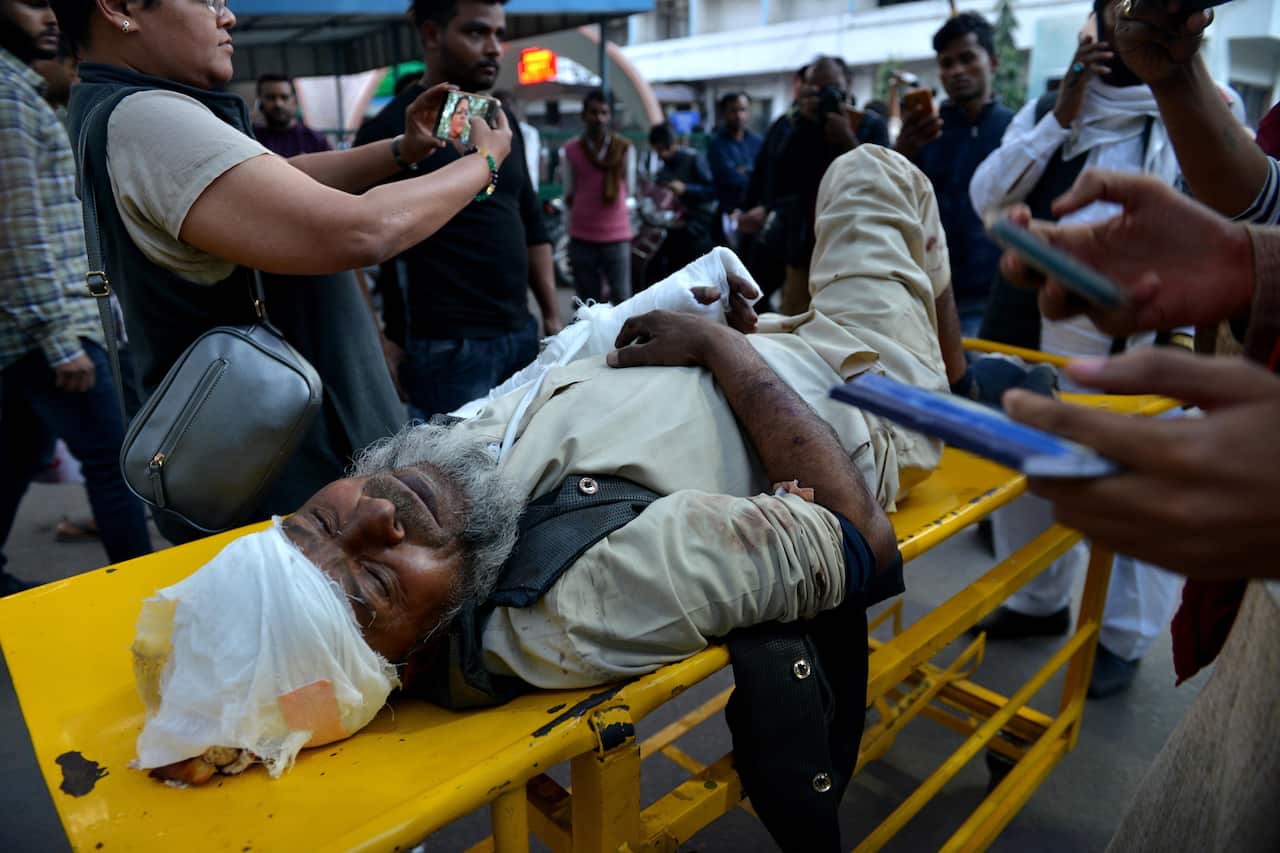 One of the injured is carried to the city hospital after riots broke out in eastern Delhi, New Delhi, India.