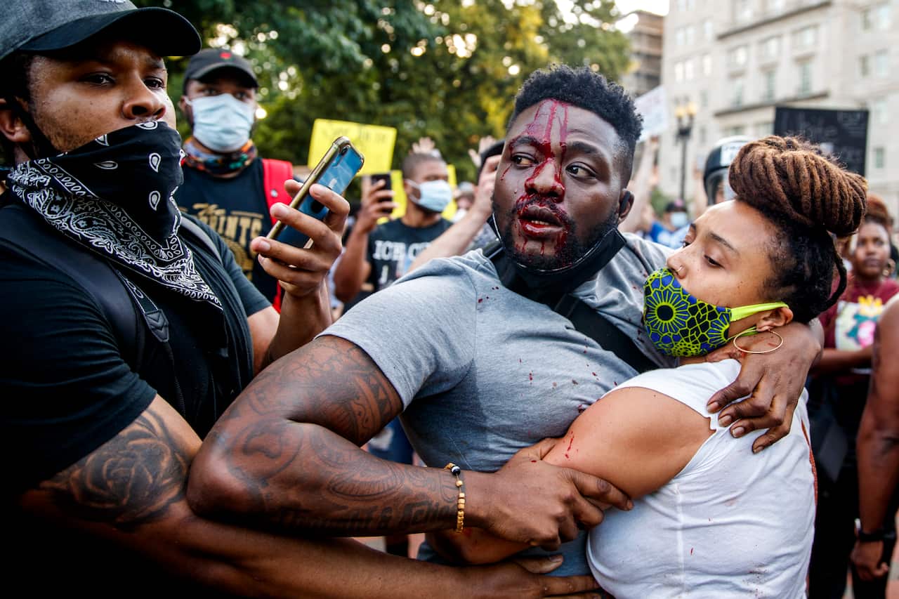  An injured man reacts during scuffles with US Park Police officers during protests over the Minneapolis death of George Floyd. 