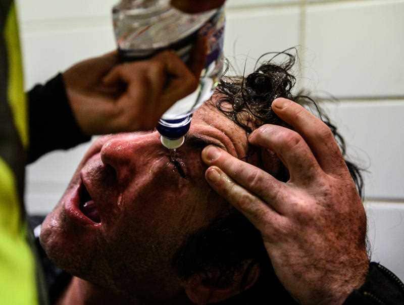 A protestor is treated for the effects of pepper spray after police sprayed protestors inside Sydney's Central Station after a Black Lives Matter rally