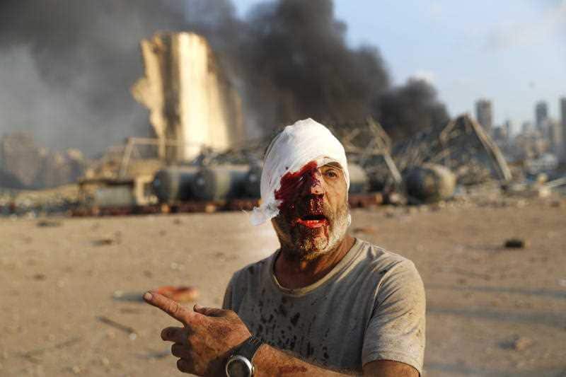A man left bloodied by the blast