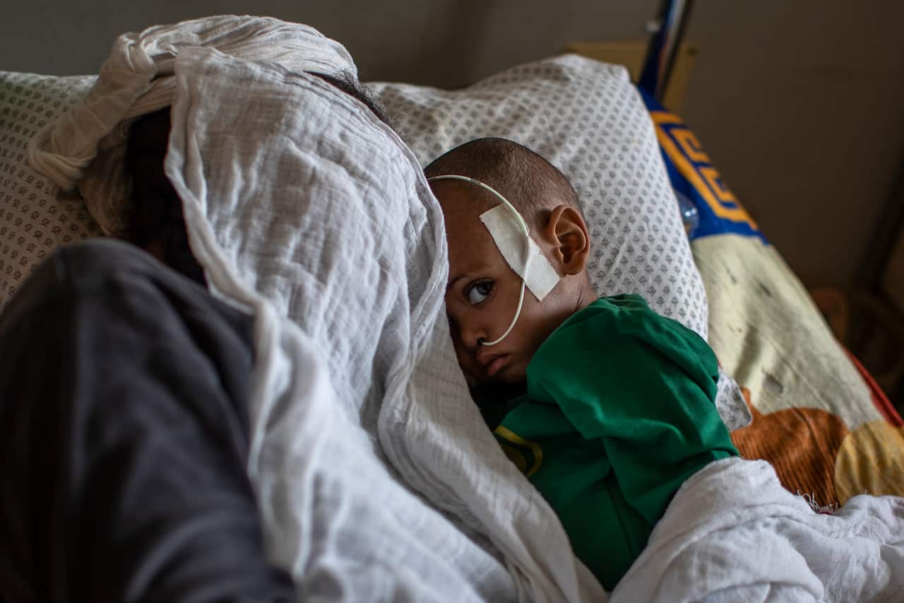 A baby suffering from malnutrition lies next to their sleeping mother at the Ayder Referral Hospital in Mekele, in the Tigray region of Ethiopia, on 6 May.