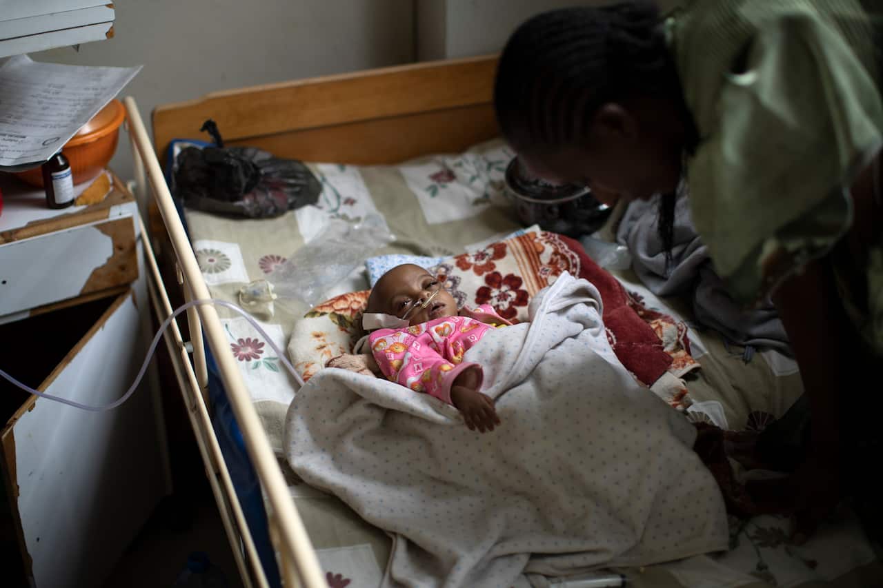 Birhan Etsana, 27, cares for her malnourished baby Mebrhit, who at 17 months old weighs just 5.2kg at the Ayder Referral Hospital in the Tigray region.