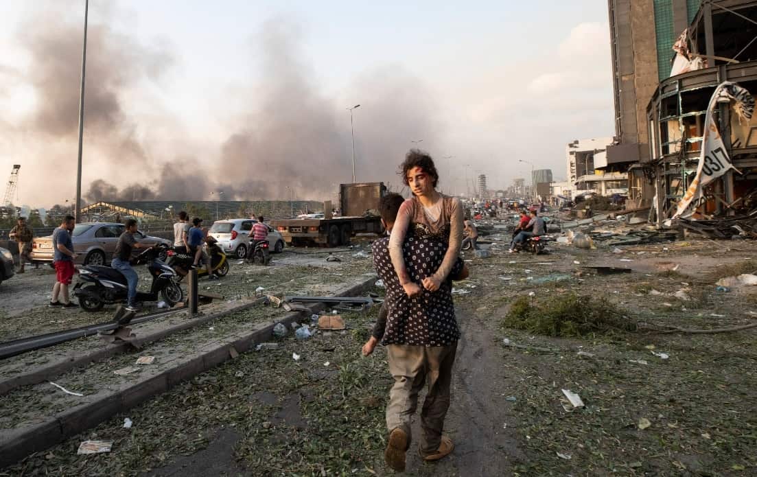 People evacuate wounded 