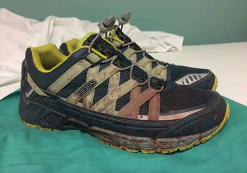 Bloodied shoes.