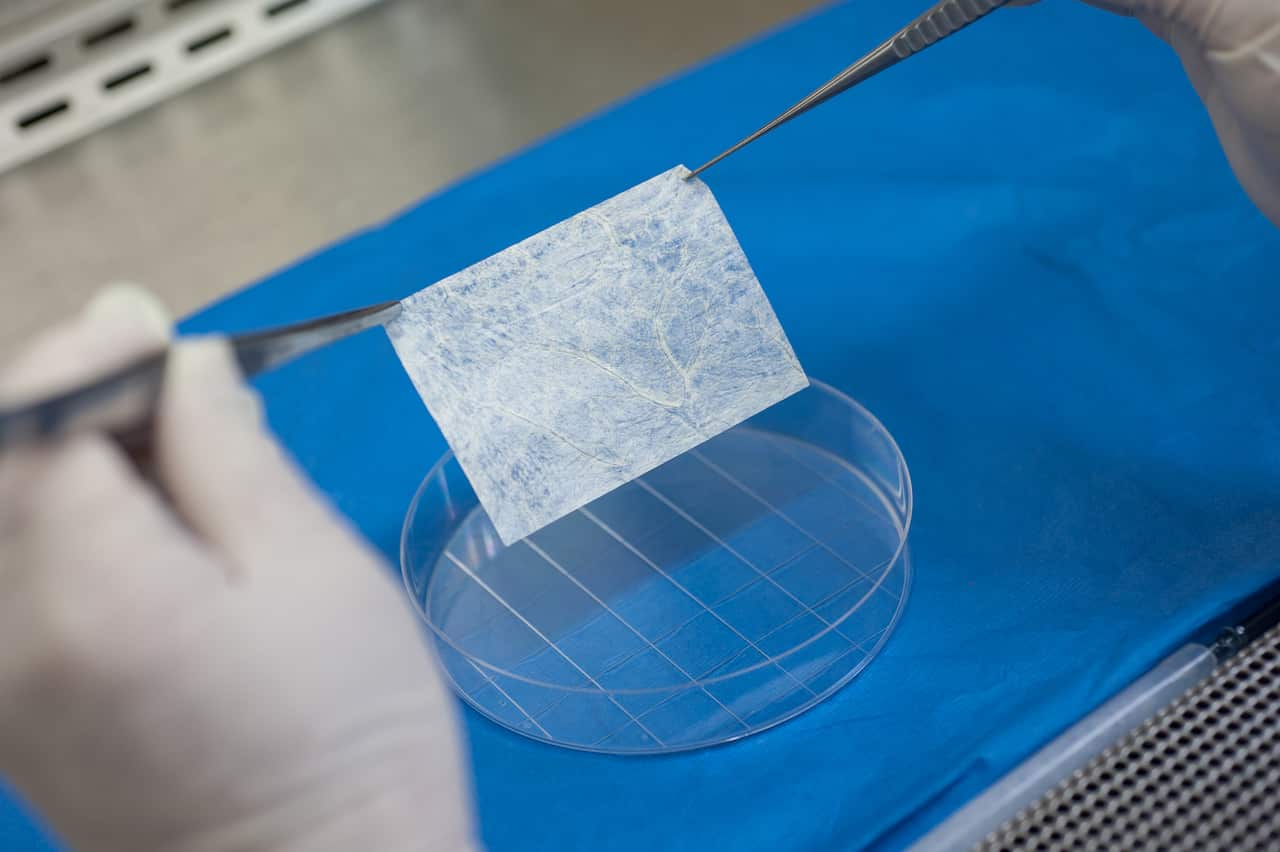 Using vulvular tissue, scientists grew smooth muscle cells and vaginal lining cells on vagina-shaped scaffolds. (Photo: Wake Forest Institute for Regenerative Medicine)