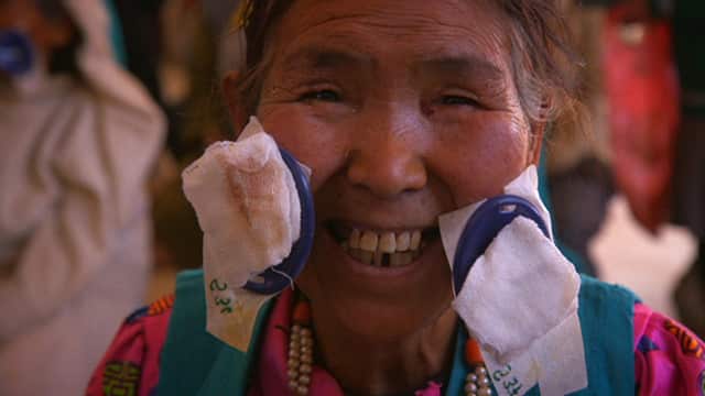 Around 24 hours later, the bandages are removed from Ang Lhamu and the delighted 70-year-old can see again.