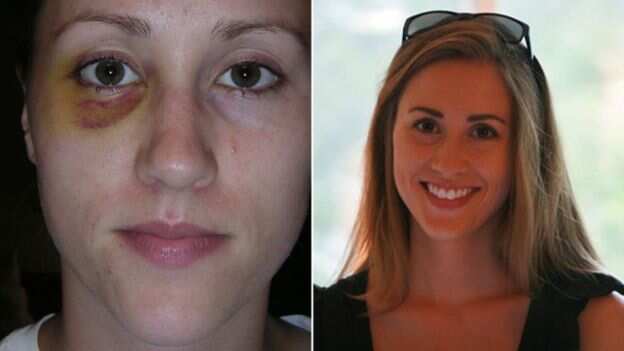 Colbie Holderness, Rob Porter's first wife, claims he punched her in the face, as shown in this 20015 image.