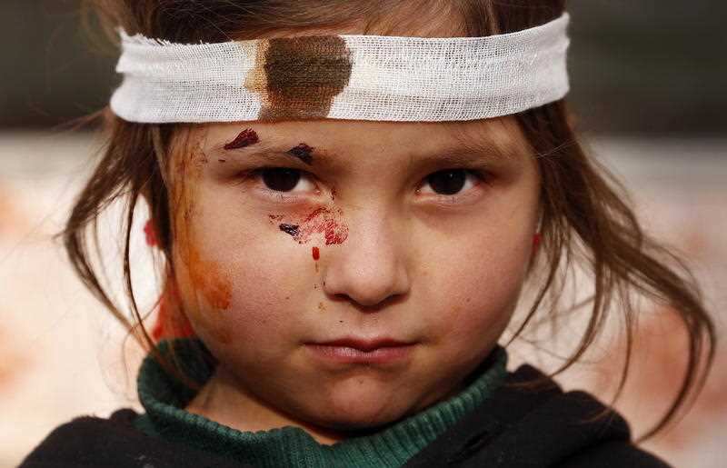 An Afghan girl, who was injured in a bomb blast in Kabul, in early 2019. According to the UN, last year was the long war’s bloodiest year.
