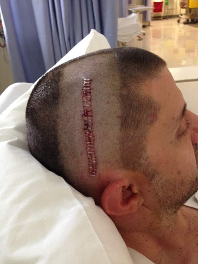 After three strokes, surgery and eight years of rehabilitation Bill Gasiamis is back at work and doing the things he loves.