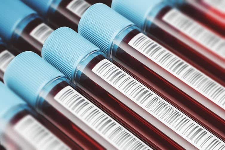 People with HIV are automatically considered a public health risk and cannot migrate to Australia permanently.