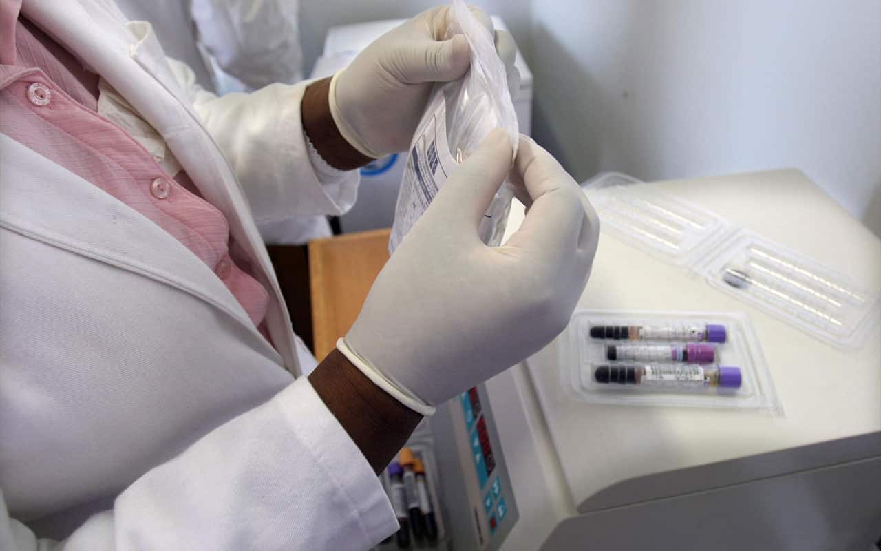 Almost 80 million people are estimated to have been infected since the virus was first diagnosed in the early 1980s. 