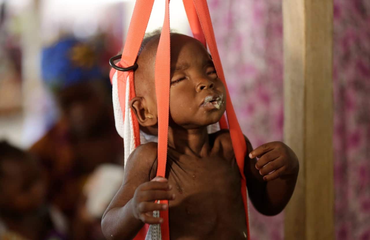A malnourished child is weighed on a scale at a clinic run by Doctors Without Borders in Maiduguri, Nigeria. (AAP)