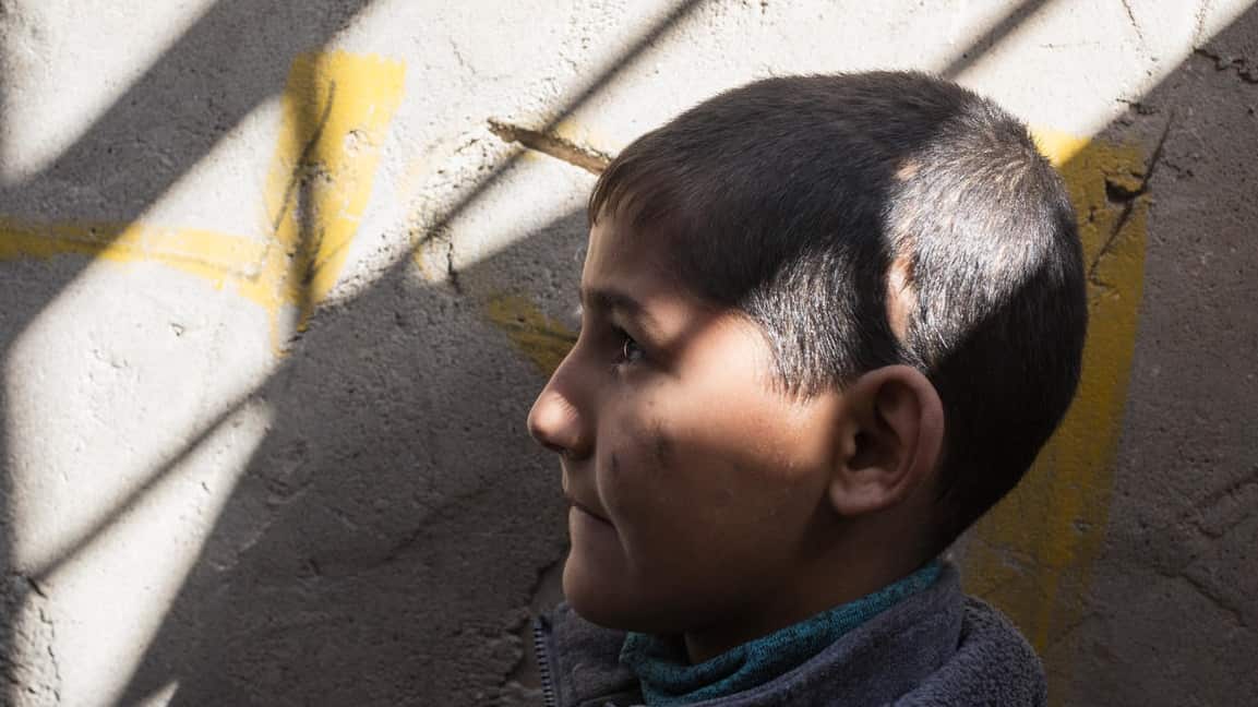 Injured boy from Iraq