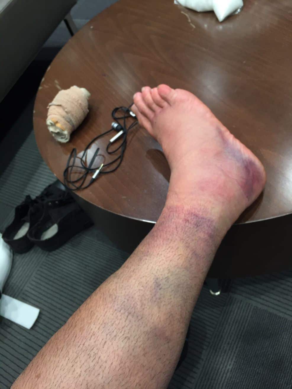 Daniel's ankle