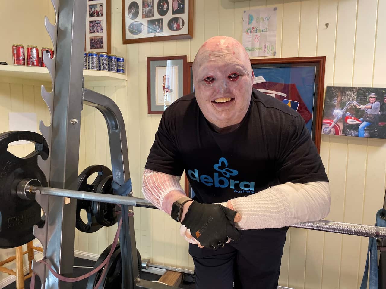 Dean Clifford was not expected to live past the age of five.