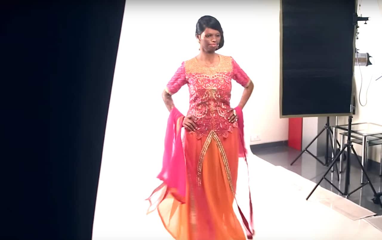 Acid attack survivor Laxmi Saa.