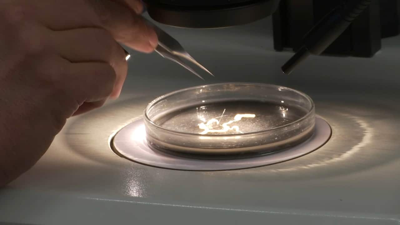 Snail genitalia under the microscope.