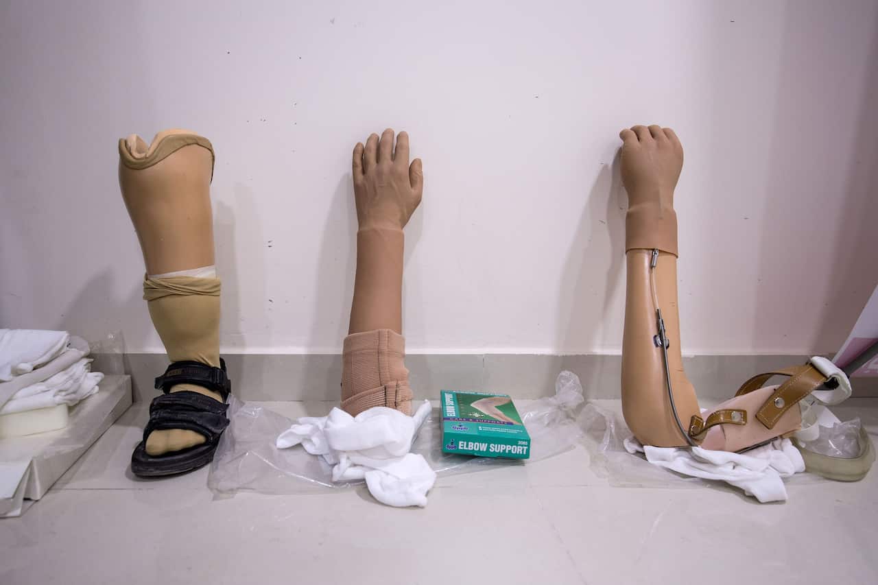 Various prosthetic limbs