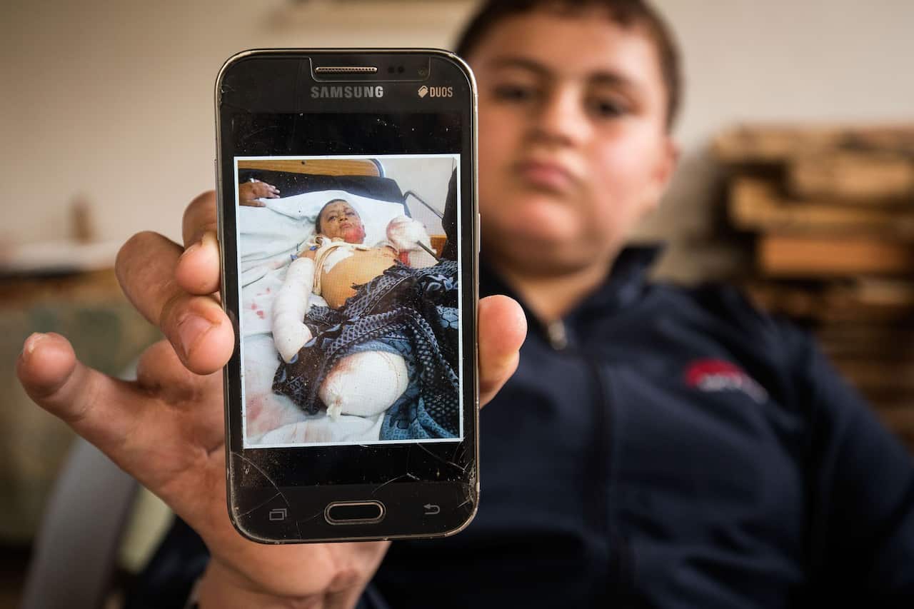 Thaer shows a picture of himself as he lays in a hospital bed with horrific injuries sustained in airstrikes.