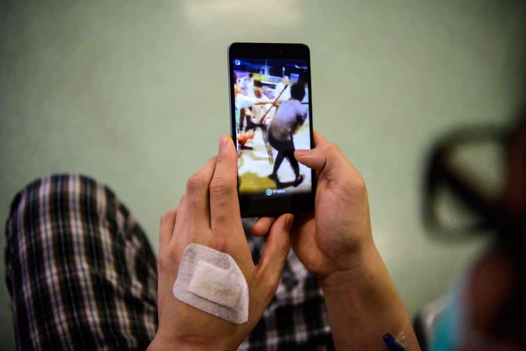 Calvin So, 23, a resident of the rural town of Yuen Long near the border with mainland China, sits in a hospital corridor in Hong Kong on July 24, 2019, watching video footage of when he was assaulted on his way back home from a nearby restaurant where he