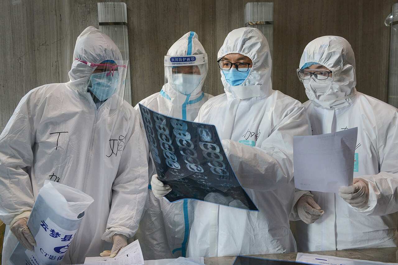 Doctors examine an x-ray of a lung at a hospital in Xiaogan city at China's central Hubei province.