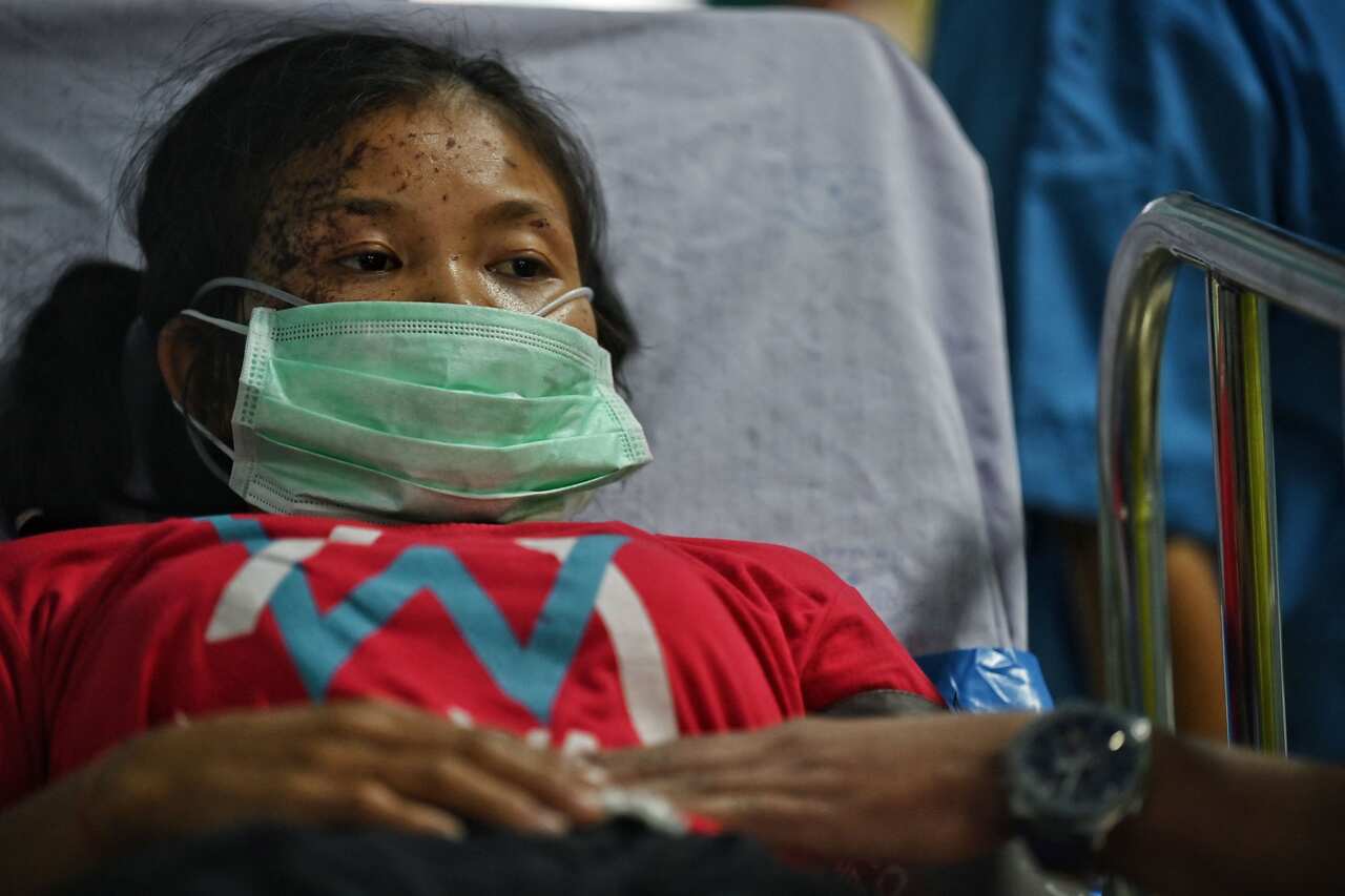 An injured Myanmar refugee in hospital after crossing Salween River at the Thailand-Myanmar border on 30 March, following military bombings in Karen state