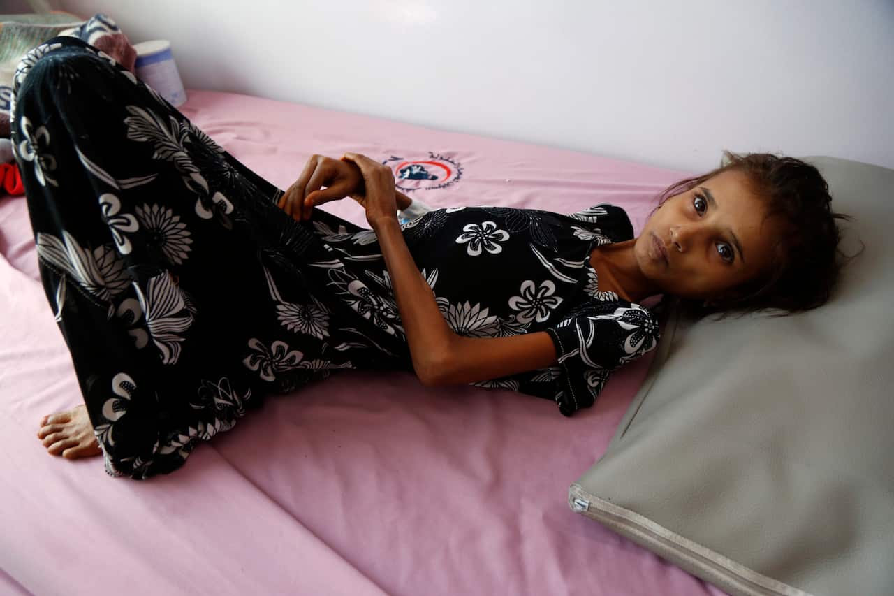 A 13-year-old Yemeni girl, Ahmadiah Abduh weighs only 11 kilos as she undergoes treatment for malnutrition at the Al-Sabeen hospital in Yemen, on 3 February.