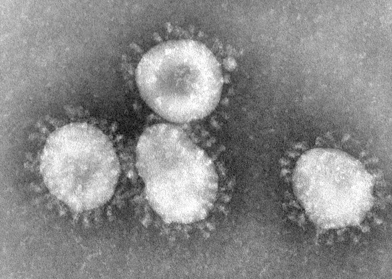 Coronavirus is not red, but appears grey under a microscope.